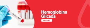 Leia mais sobre o artigo Hemoglobina Glicada